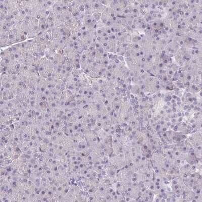 Immunohistochemistry-Paraffin: Drebrin 1 Antibody [NBP2-38813]