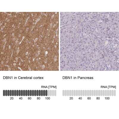 Immunohistochemistry-Paraffin: Drebrin 1 Antibody [NBP2-38813]