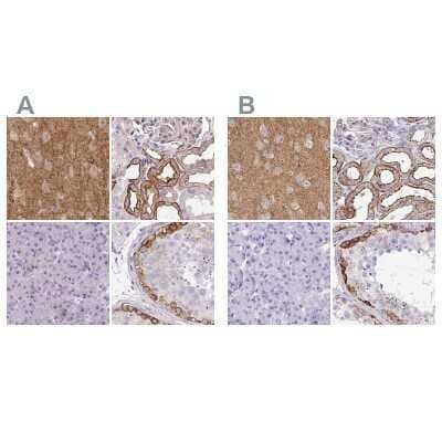 Immunohistochemistry-Paraffin: Drebrin 1 Antibody [NBP2-38813]