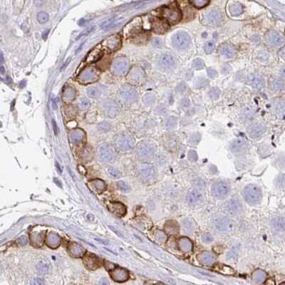 Immunohistochemistry-Paraffin: Drebrin 1 Antibody [NBP2-38813]