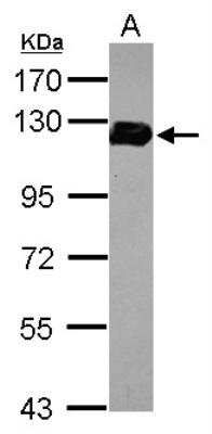Western Blot: Drebrin 1 Antibody [NBP2-14932]