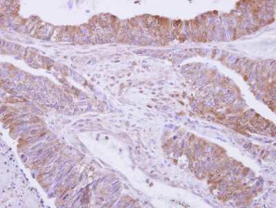 Immunohistochemistry-Paraffin: Drebrin 1 Antibody [NBP2-14933]