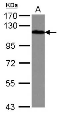 Western Blot: Drebrin 1 Antibody [NBP2-14933]