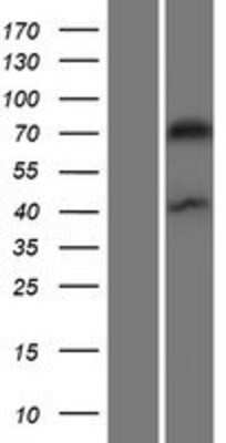 Western Blot: Drebrin 1 Overexpression Lysate [NBP2-10588]