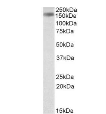 Western Blot: Drosha Antibody [NB100-55410]