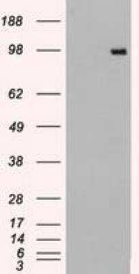 Western Blot: Dtk/TYRO3 Antibody (OTI2C4) [NBP1-48040]