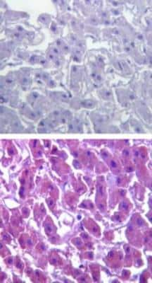 Immunohistochemistry-Paraffin: Dtk/TYRO3 Antibody [NBP2-23725]