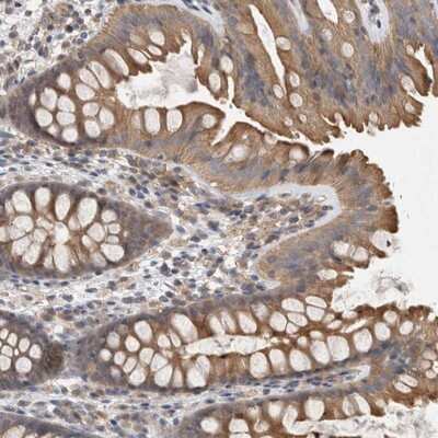 Immunohistochemistry-Paraffin: Dynactin 6 Antibody [NBP1-80616]