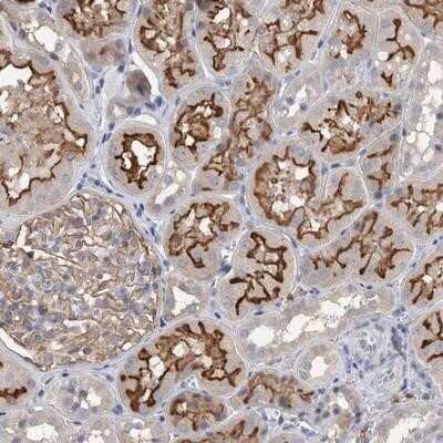 Immunohistochemistry-Paraffin: Dynactin 6 Antibody [NBP1-80617]