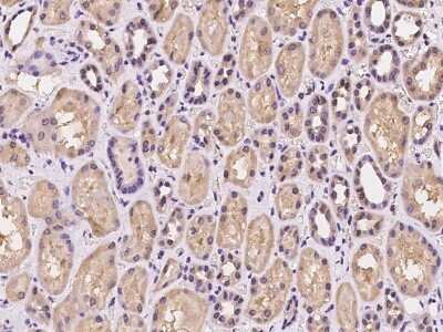 Immunohistochemistry-Paraffin: Dynactin 6 Antibody [NBP2-97258]