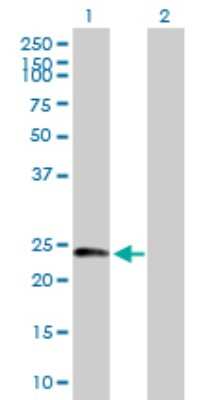 Western Blot: Dynactin 6 Antibody [H00010671-B01P]