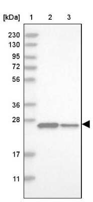 Western Blot: Dynactin 6 Antibody [NBP1-80616]