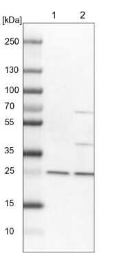 Western Blot: Dynactin 6 Antibody [NBP1-80616]