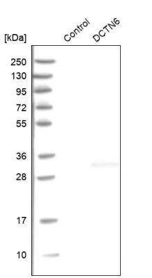 Western Blot: Dynactin 6 Antibody [NBP1-80617]