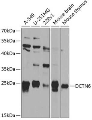 Western Blot: Dynactin 6 AntibodyBSA Free [NBP2-92536]