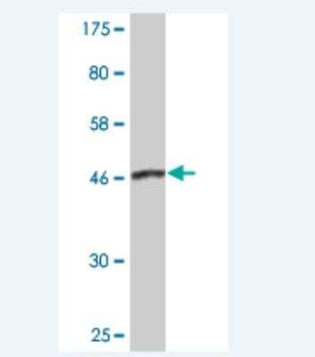 Western Blot: Dynactin Subunit 1/DCTN1 Antibody (2E4-1C2) [H00001639-M02]