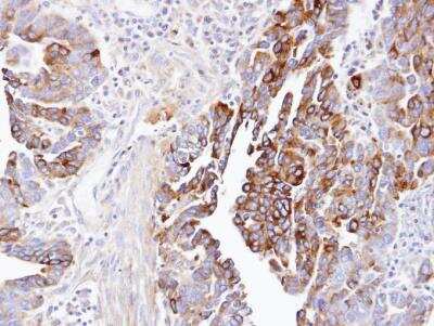Immunohistochemistry-Paraffin: Dynactin Subunit 1/DCTN1 Antibody [NBP1-30880]