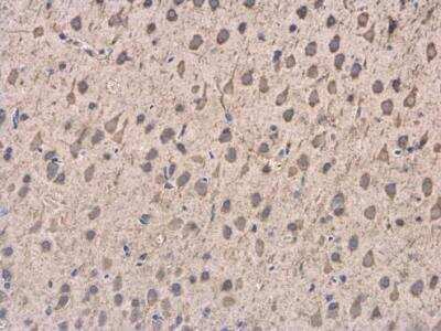 Immunohistochemistry-Paraffin: Dynactin Subunit 1/DCTN1 Antibody [NBP1-30880]
