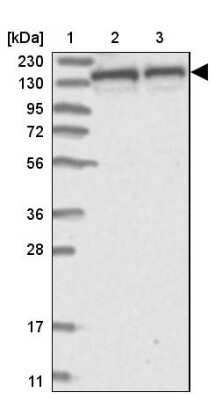 Western Blot: Dynactin Subunit 1/DCTN1 Antibody [NBP2-33976]