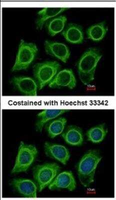 Immunocytochemistry/ Immunofluorescence: Dynactin Subunit 2/DCTN2/DCTN-50 Antibody [NBP2-16115]