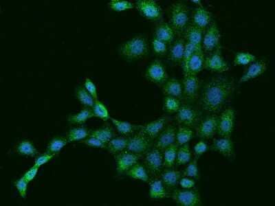 Immunocytochemistry/ Immunofluorescence: Dynactin Subunit 2/DCTN2/DCTN-50 Antibody [NBP2-97257]