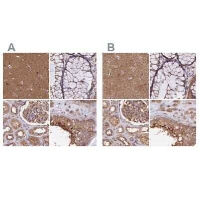 Immunohistochemistry-Paraffin: Dynactin Subunit 2/DCTN2/DCTN-50 Antibody [NBP1-85277]