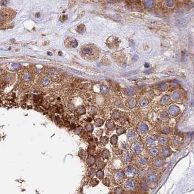Immunohistochemistry-Paraffin: Dynactin Subunit 2/DCTN2/DCTN-50 Antibody [NBP1-85277]