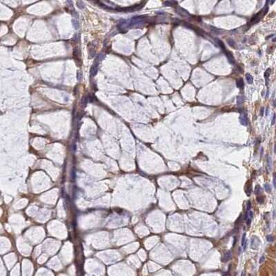 Immunohistochemistry-Paraffin: Dynactin Subunit 2/DCTN2/DCTN-50 Antibody [NBP1-85277]