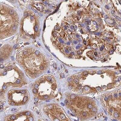 Immunohistochemistry-Paraffin: Dynactin Subunit 2/DCTN2/DCTN-50 Antibody [NBP1-85277]