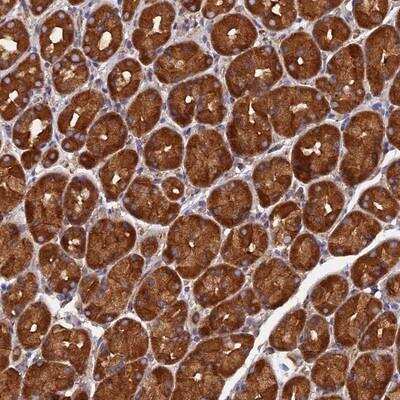 Immunohistochemistry-Paraffin: Dynactin Subunit 2/DCTN2/DCTN-50 Antibody [NBP1-85278]