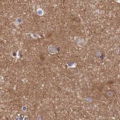 Immunohistochemistry-Paraffin: Dynactin Subunit 2/DCTN2/DCTN-50 Antibody [NBP1-85278]