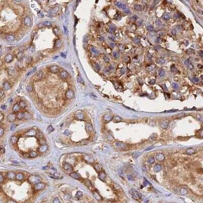Immunohistochemistry-Paraffin: Dynactin Subunit 2/DCTN2/DCTN-50 Antibody [NBP1-85278]