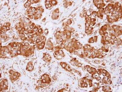 Immunohistochemistry-Paraffin: Dynactin Subunit 2/DCTN2/DCTN-50 Antibody [NBP2-16115]