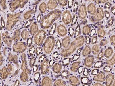 Immunohistochemistry-Paraffin: Dynactin Subunit 2/DCTN2/DCTN-50 Antibody [NBP2-97257]
