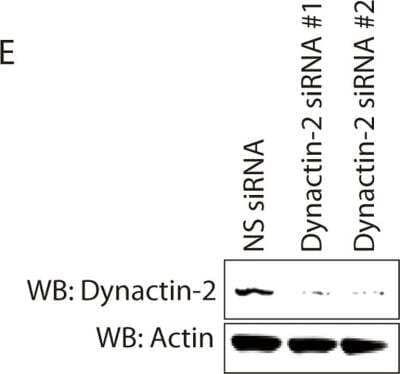 Knockdown Validated: Dynactin Subunit 2/DCTN2/DCTN-50 Antibody [NBP1-85277]