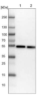 Western Blot: Dynactin Subunit 2/DCTN2/DCTN-50 Antibody [NBP1-85277]
