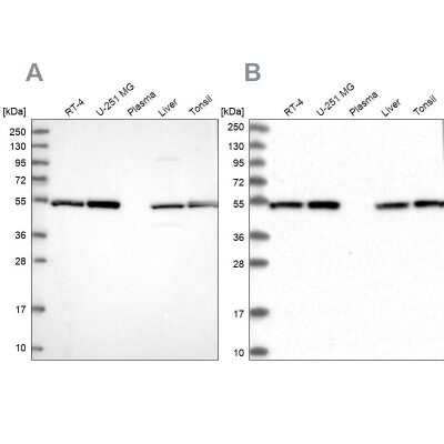 Western Blot: Dynactin Subunit 2/DCTN2/DCTN-50 Antibody [NBP1-85277]