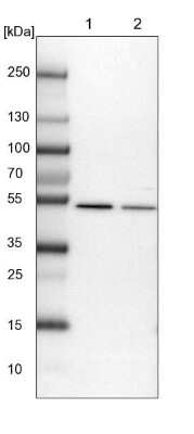 Western Blot: Dynactin Subunit 2/DCTN2/DCTN-50 Antibody [NBP1-85278]