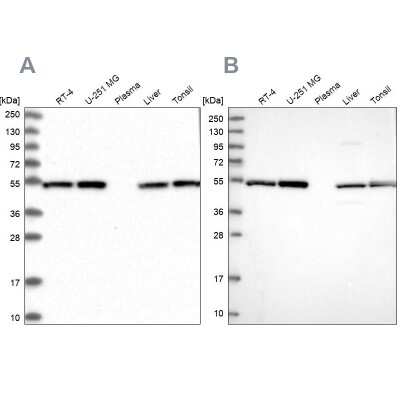 Western Blot: Dynactin Subunit 2/DCTN2/DCTN-50 Antibody [NBP1-85278]