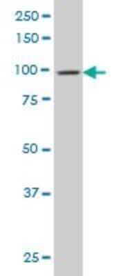 Western Blot: Dynamin 2 Antibody (6C9) [H00001785-M01]