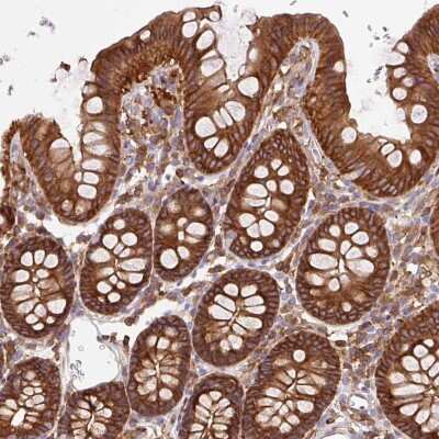 Immunohistochemistry-Paraffin: Dynamin 2 Antibody [NBP2-47477]