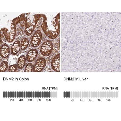 Immunohistochemistry-Paraffin: Dynamin 2 Antibody [NBP2-47477]