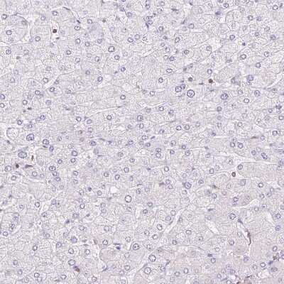 Immunohistochemistry-Paraffin: Dynamin 2 Antibody [NBP2-47477]