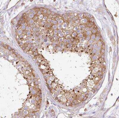 Immunohistochemistry-Paraffin: Dynamin 2 Antibody [NBP2-47477]