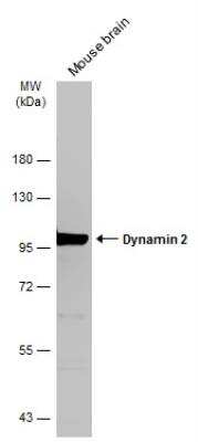 Western Blot: Dynamin 2 Antibody [NBP2-16244]