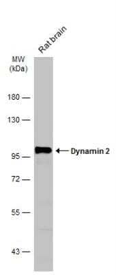 Western Blot: Dynamin 2 Antibody [NBP2-16244]