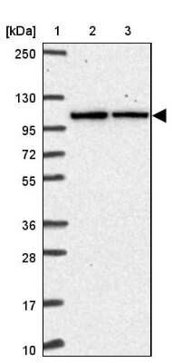 Western Blot: Dynamin 2 Antibody [NBP2-47477]