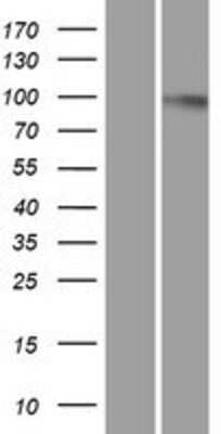 Western Blot: Dynamin 2 Overexpression Lysate [NBP2-11313]