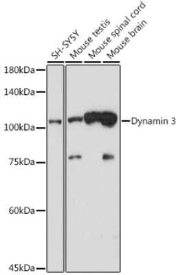 Western Blot: Dynamin 3 Antibody (5X7T4) [NBP3-15722]