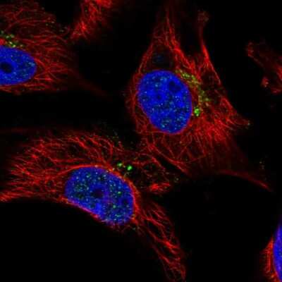 Immunocytochemistry/ Immunofluorescence: Dynamin 3 Antibody [NBP2-56017]